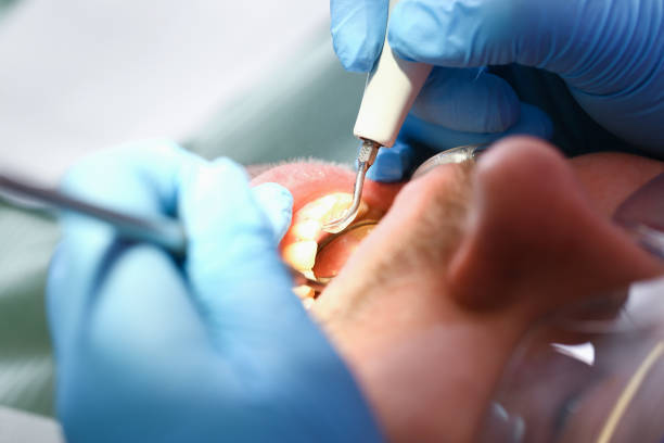 Best Emergency Gum Treatment in West Wyoming, PA