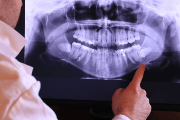 Best Emergency Treatment for Dental Infections or Abscesses in West Wyoming, PA