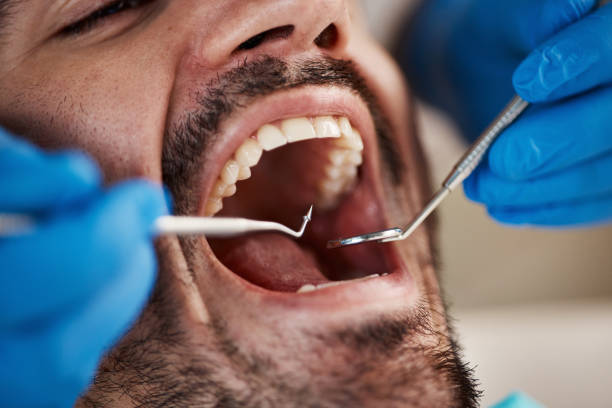 Best Emergency Tooth Extraction in West Wyoming, PA
